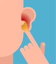 Finger in ear. Pick earwax with your finger. vector illustration