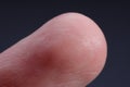 Finger with friction ridges on dark background, macro view Royalty Free Stock Photo