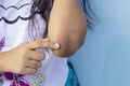 Finger of girl point to her elbow because dark patches on the skin and allergic rash known as acanthosis nigricans look like a dar Royalty Free Stock Photo