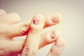 Finger with onychomycosis. A toenail fungus.. - soft focus