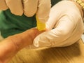 Finger-prick blood test in clinic