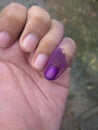 A Finger with purple tinted