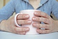 Fingernails with white dots and stripes. Leukonychia, opaque white discoloration of nails Royalty Free Stock Photo