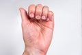 Fingers with badly or chewed bitten nails on gray background Royalty Free Stock Photo