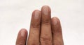 Fingers of human body. Cutting nails. Index finger. Ring finger. Pinky finger. Royalty Free Stock Photo