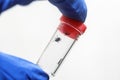 Fingers in medical gloves holding a plastic transparent jar flask with dangerous insects mites removed from the animal for