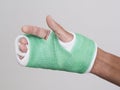 Fingers of right hand in green cast