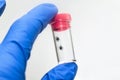 Fingers in rubber medical gloves holding a plastic transparent jar flask with dangerous insects mites removed from the animal for