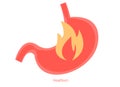 Fire in stomach. Excessive acidity gastritis gastric ulcer heartburn stomach disease