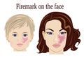 Firemark on the face