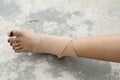 First aid accident wrist with liniment