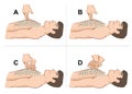 First Aid cardiac resuscitation CPR, open heart massage