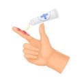 First Aid for Hand with Ambustion or Burn on the Skin Vector Illustration