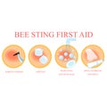 First aid infographic. Remove sting from the skin, area in pain