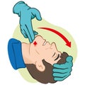 First Aid person opening the mouth clearing airway with gloves