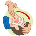 First Aid person opening the mouth clearing airway