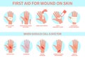 First aid for wound on skin. Damage, bleeding cut hand skin and emergency treatment procedure, therapy injury medical