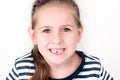 First missing tooth Royalty Free Stock Photo