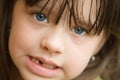 First missing tooth Royalty Free Stock Photo