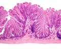 Duodenum. BrunnerÃ¢â¬â¢s glands Royalty Free Stock Photo