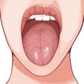 Fissured tongue is a benign condition characterized by fissures in the dorsum of the tongue. Royalty Free Stock Photo