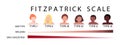 Fitzpatrick scale skin types infographic vector illustration