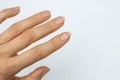 five dirty hand nails on white background