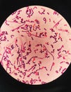 yeast cells and hyphae in gram stain fine with microscope.