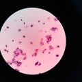 yeast cells in gram stain fine with microscope.