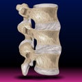 Spondylitis - Human Anatomy - Healthcare - Science