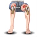 Knee Joint Pain Silhouette Icon Ache of Knee, Skeleton, Arthritis, - illustration on white background