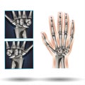 Wrist Anatomy - Human Body - Science - Healthcare Royalty Free Stock Photo