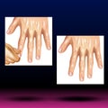 Male Fingers - Healthcare - Science - Medical Treatment - Organ