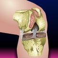Injury and Inflammation, Knee Joint Pain Silhouette Icon Ache of Knee, Arthritis