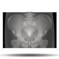 X-Ray of Pelvis - Human Body - Science - Healthcare Royalty Free Stock Photo