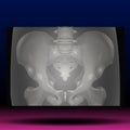 X-Ray of Pelvis - Human Body - Science - Healthcare Royalty Free Stock Photo