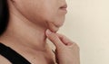 The flabbiness adipose hanging under the neck, cellulite under the chin. Royalty Free Stock Photo