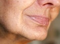 Flabbiness of the skin of the cheeks. Wrinkles on the face. Nasolabial wrinkles. Royalty Free Stock Photo