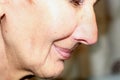 Flabbiness of the skin of the cheeks. Wrinkles on the face. Nasolabial wrinkles. Royalty Free Stock Photo