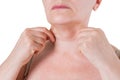 Flabby skin on the neck of an elderly woman isolated on white background Royalty Free Stock Photo