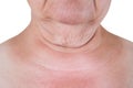 Flabby skin on the neck of an elderly woman isolated on white background Royalty Free Stock Photo