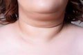 Flabby skin on the neck of an fat woman, female double chin on gray background Royalty Free Stock Photo
