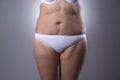 Flabby woman`s belly with stretch marks Royalty Free Stock Photo