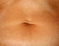 Flabby wrinkled abdomen. The navel is stretched.