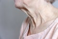 A flabby wrinkled excess skin on the neck of a senior woman close up