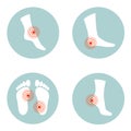 Flat design of a health care concept, Pain and injuries in body parts. woman is feeling pain in foot, ankle and toes