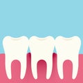 Flat design illustration of three teeth, gums and gingivitis. Dental Care, Isolated On Blue-Green Background, Vector