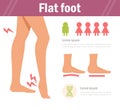 Flat foot. Vector. Cartoon.