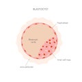 Flat illustration of blastocyst cell structure with captions Royalty Free Stock Photo