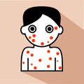 Flat illustration of chicken pox or smallpox, kid vector icon for web design